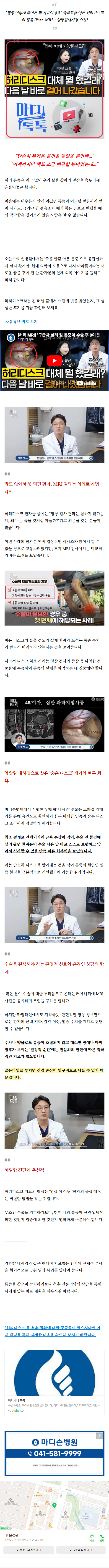 천안척추골절 caths